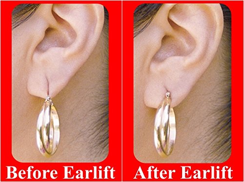 Original EARLIFT USA "Invisible Ear Lobe Support Waterproof Medical Patches"